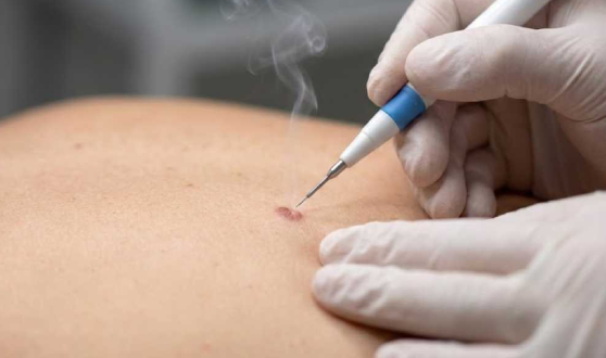 Tratamento dermatológico personalizado