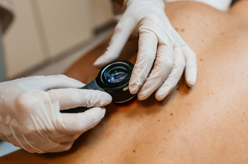 Dermato-Oncologia